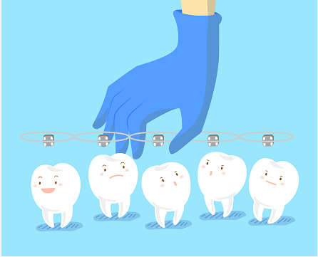 牙齿矫正需要多长时间？矫正过快会导致什么后果？