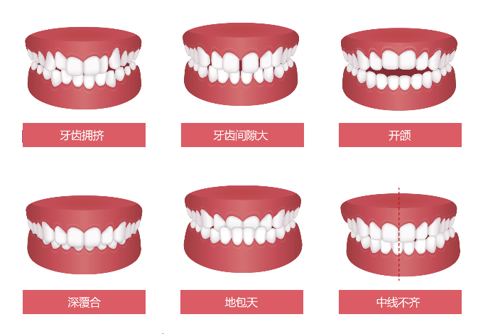 什么是牙齿矫正？牙齿矫正能改变什么问题？