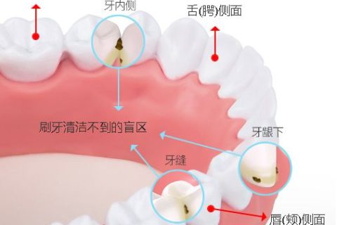 牙黄口臭！天天都刷牙，你的牙齿依旧很脏！
