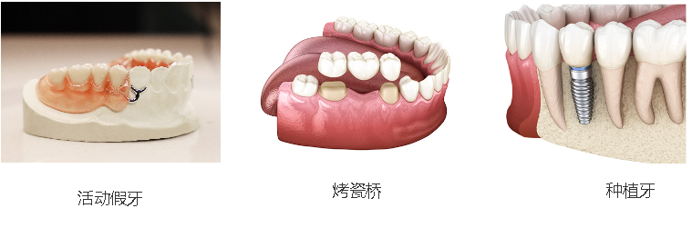 镶牙和补牙有什么区别？