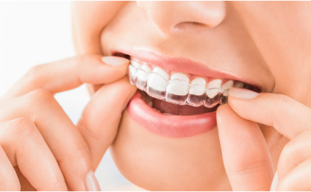 关于牙齿矫正，你需要避免这些误区！