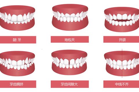 影响牙齿矫正价格的因素有哪些？